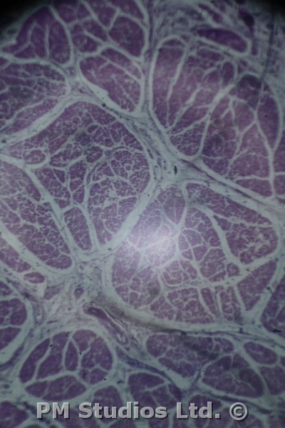 bright spot in the microscope